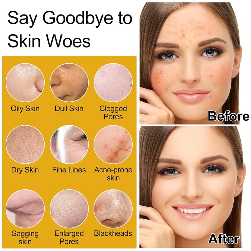 Milk Rice Water Skincare Set for Women & Teens - Anti-Aging Gift