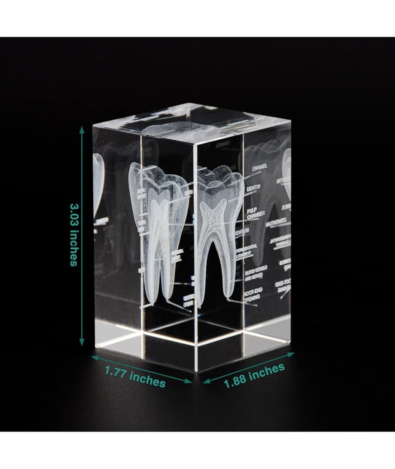 3D Crystal Tooth Model - Laser Etched Anatomical Decor
