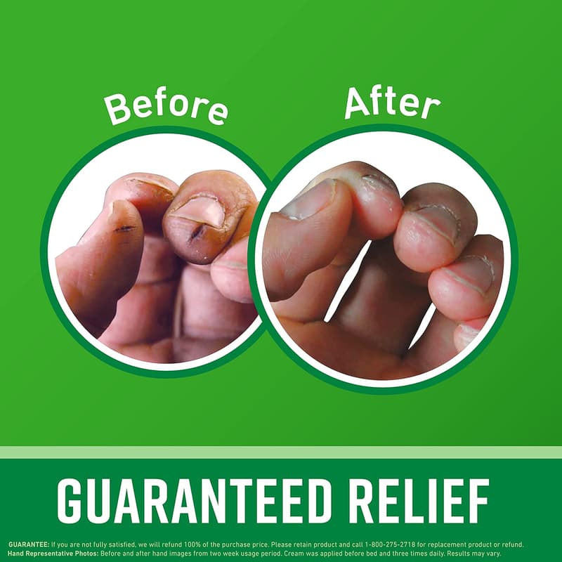 Extreme Dryness Hand Cream - O'Keeffe's 3.4 oz Repair Formula