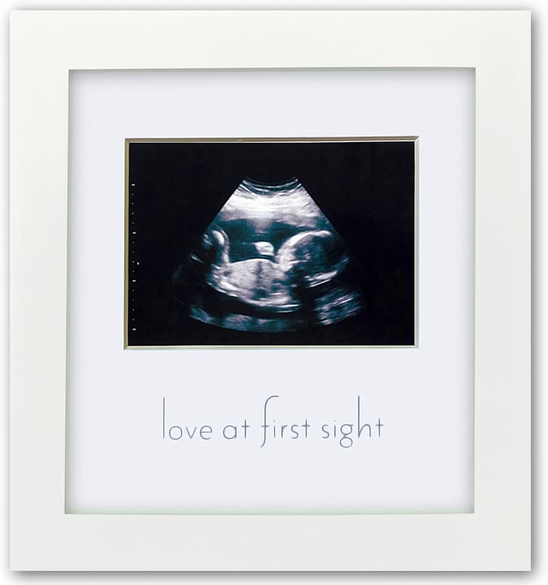 Green Pollywog Ultrasound Frame | Pregnancy Gift for Moms