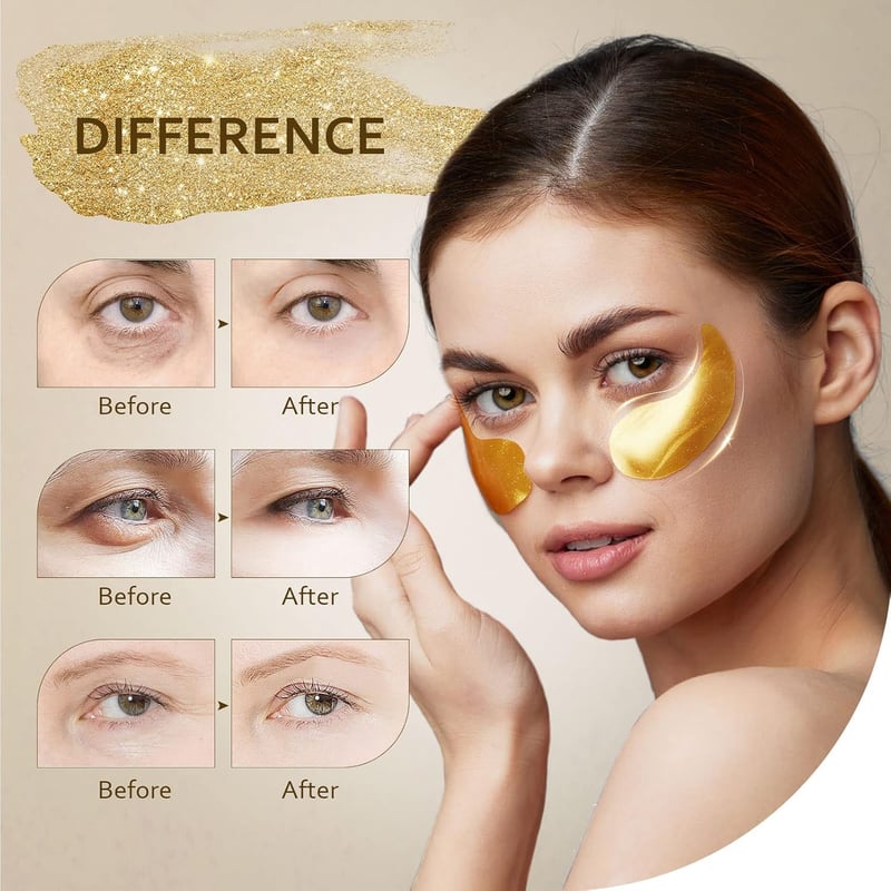 24K Gold Under Eye Masks (30 Pairs) for Puffiness & Dark Circles