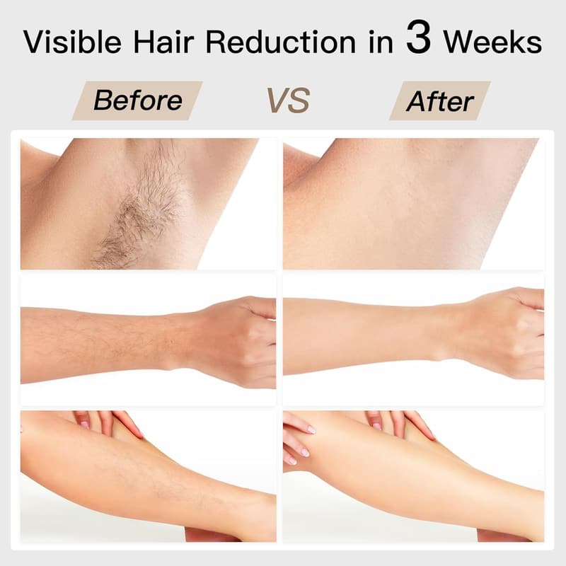 BoSidin IPL Laser Hair Removal Kit for Women with Cooling & 6 Modes