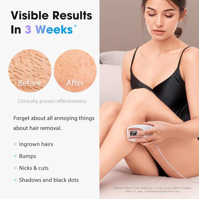 Home IPL Laser Hair Removal Device with Ice-Cooling - Rose Gold