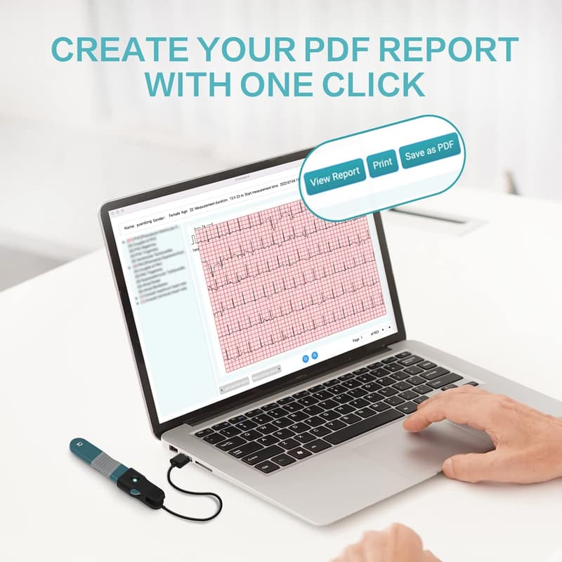 AI HR Monitor – 24-Hour Chest Lead Device with Free Analysis