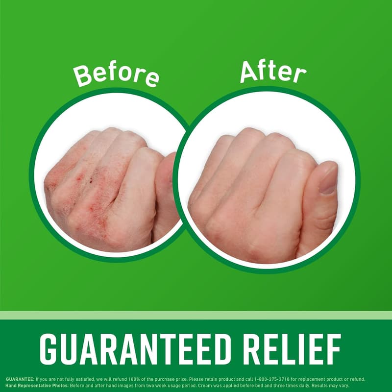 Extreme Dryness Hand Cream - Repairing Skincare for Cracked Hands