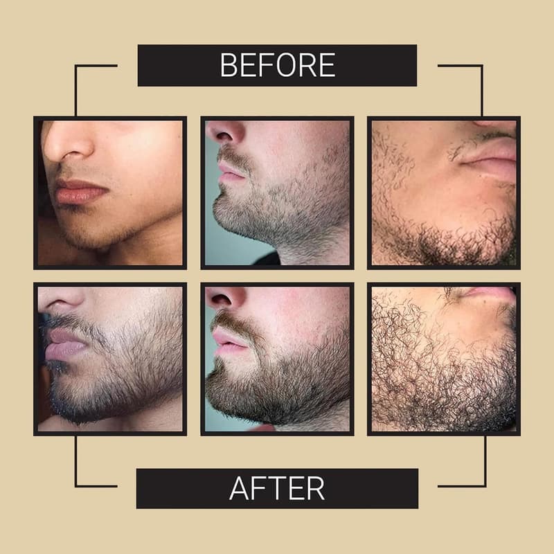 Beard Growth Oil Serum - Unscented, 1 fl Oz for Thicker Beards