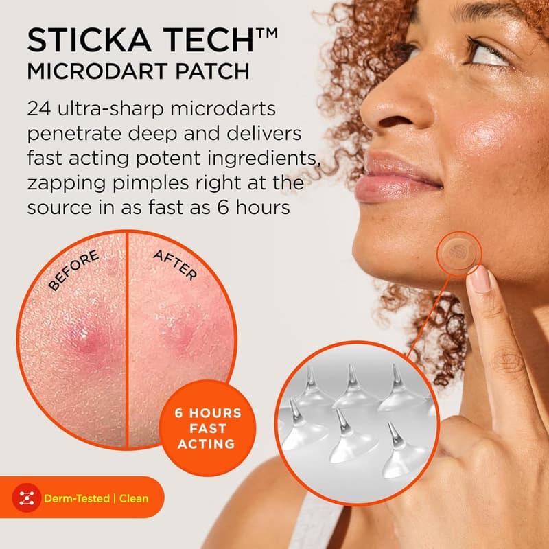 ZitSticka Killa Acne Patches - Fast-Acting Microdart Solution