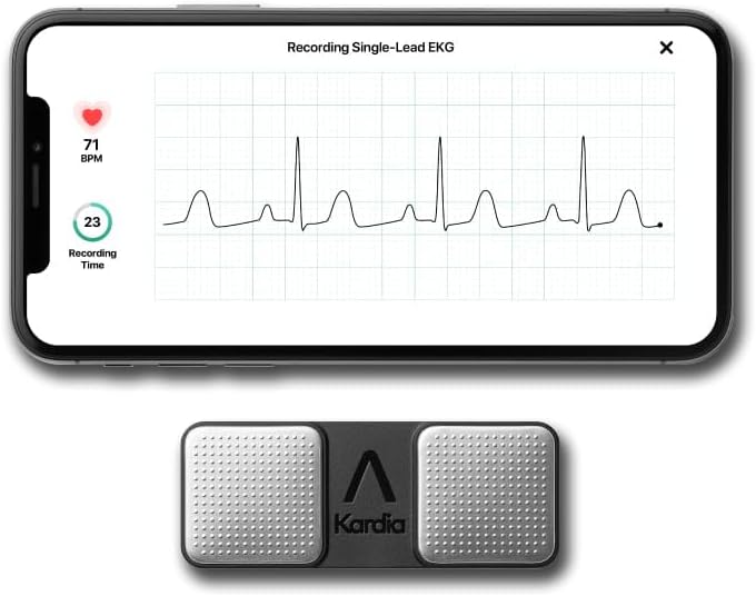 KardiaMobile EKG Monitor – Detects AFib & Irregular Heartbeats
