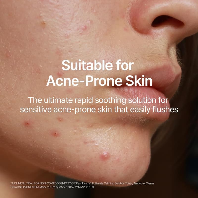 Mother's Day Skincare Set - Calming Toner, Ampoule & Cream
